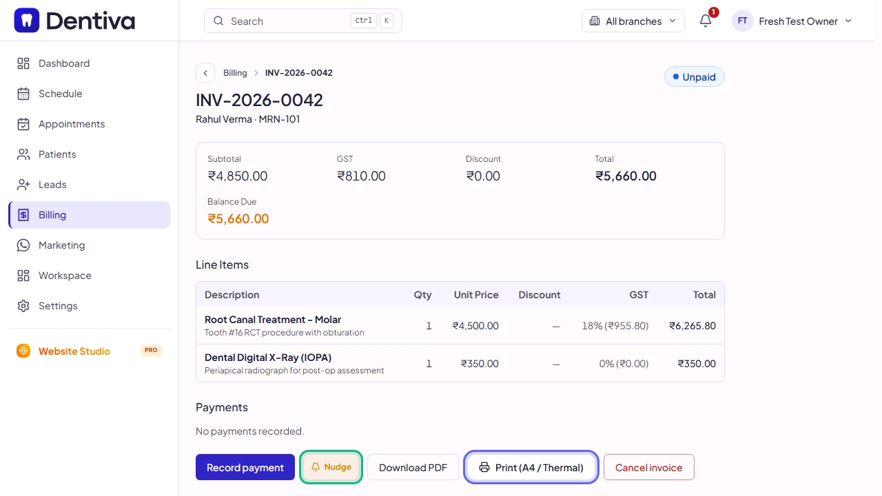 Finalized Invoice Detail View with Print and WhatsApp Share Actions